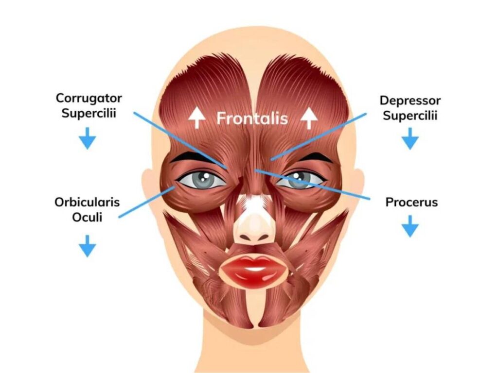 botox for droopy eyelid