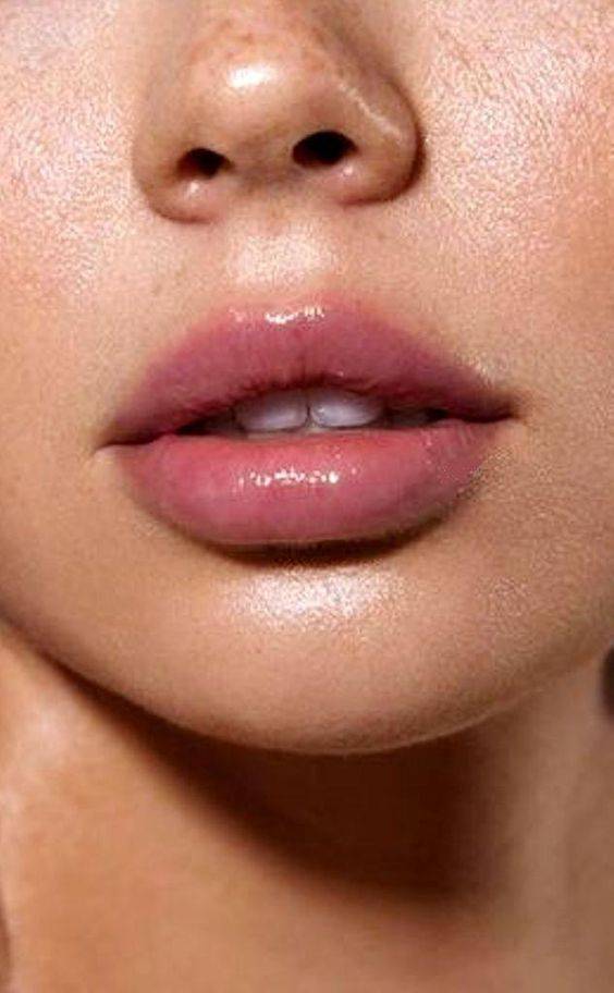 are lip injections safe