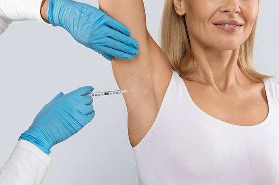 botox in armpits