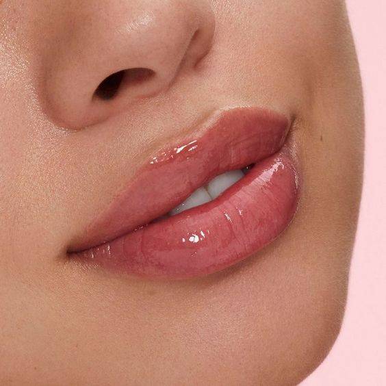 how long does juvederm last in lips