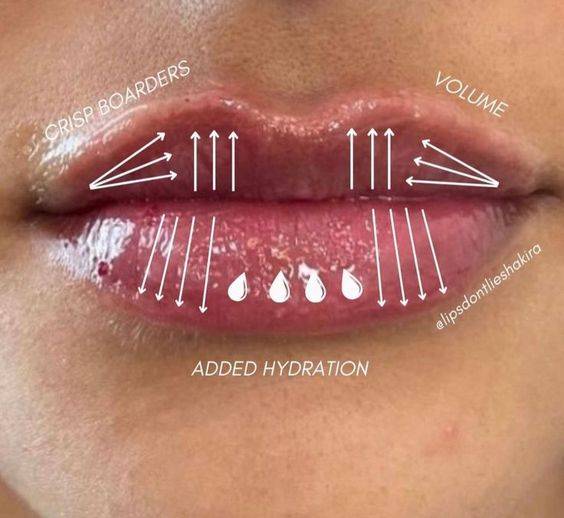 lip injection healing process