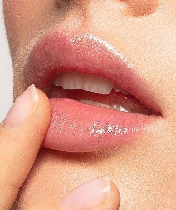 reasons for swelling after lip injections?