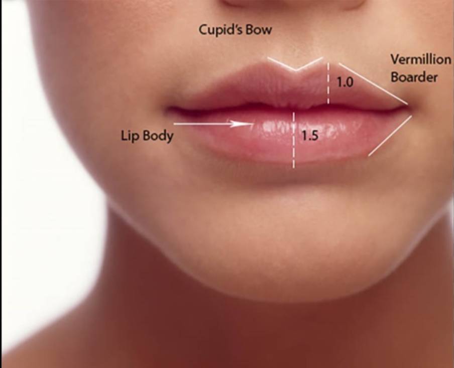 1 ml lip shape lip fillers