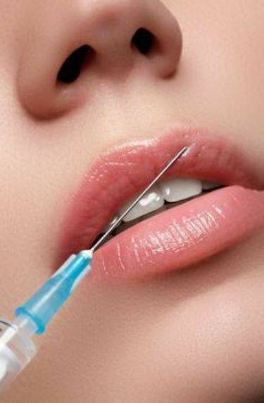 what to do after lip filler