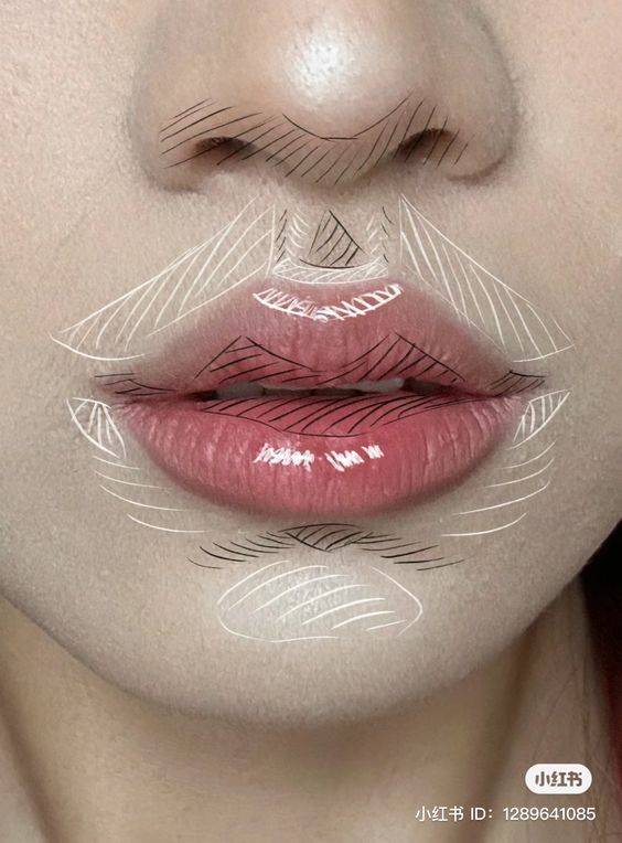 what to do after lip filler