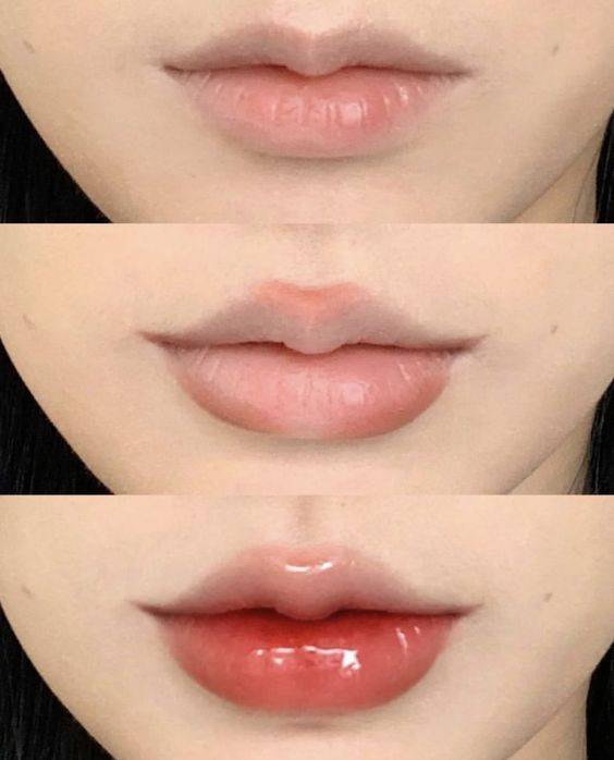 what to eat after lip fillers