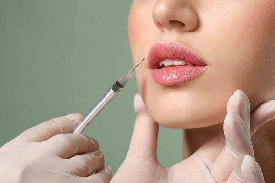  what to put on lips after filler