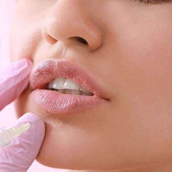  what to Put on Lips After Filler