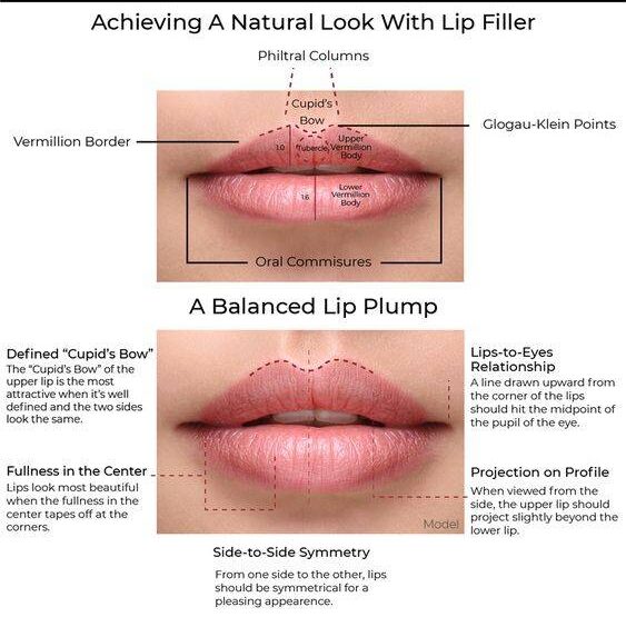 where not to inject lip filler