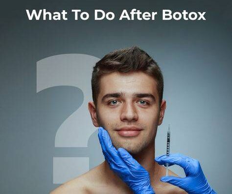 after botox care