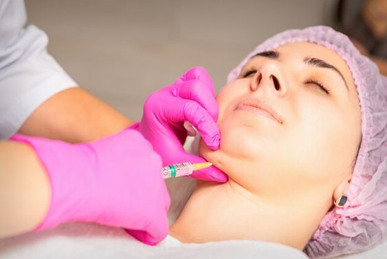 Alternatives to Mesotherapy for Double Chin