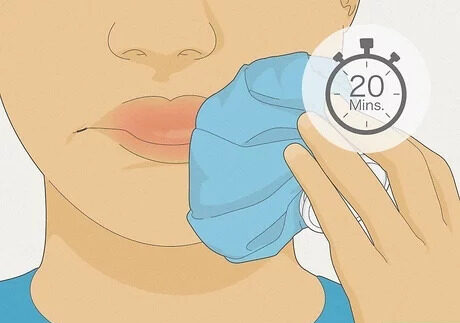 Applying Cold Compresses lip