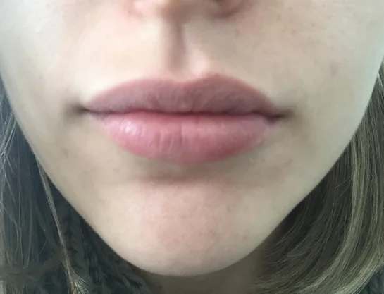 Asymmetrical Lips