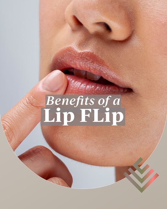 Benefits of a Botox Lip Flip