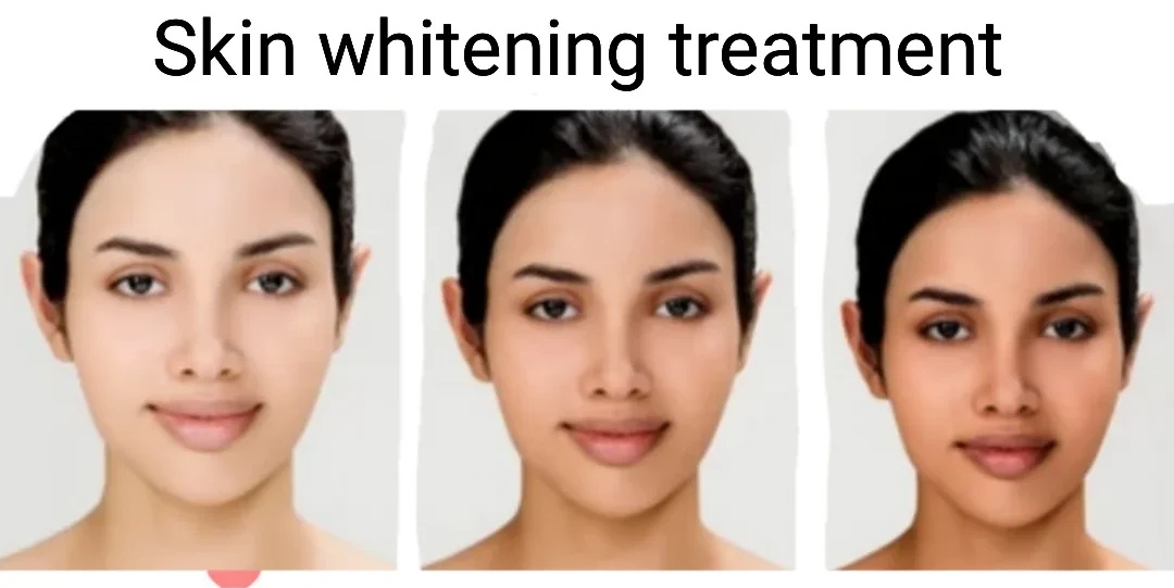 Benefits of IV Drip for Skin Lightening