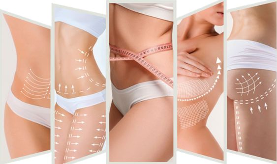 Benefits of Mesotherapy Fat Melting