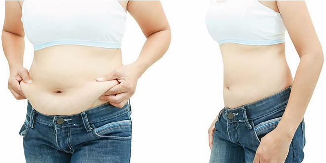 Benefits of Mesotherapy for Weight Loss