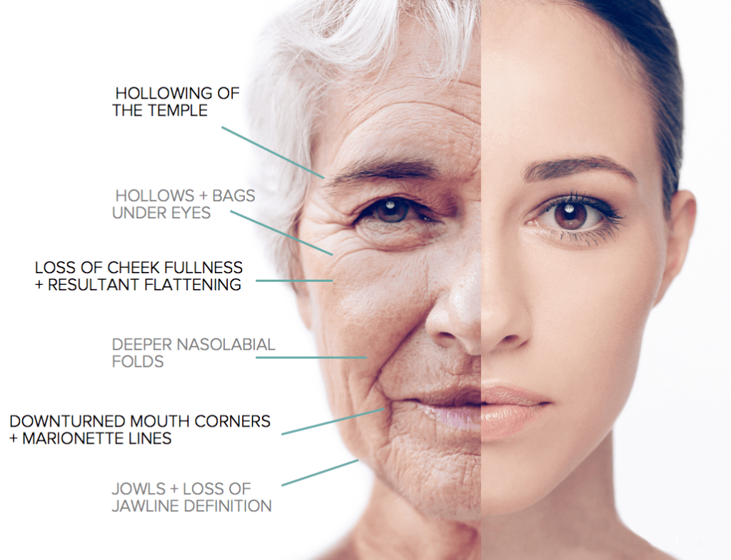 Benefits of Using Wrinkle Fillers