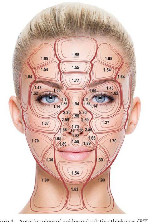 botox before and after crow's feet