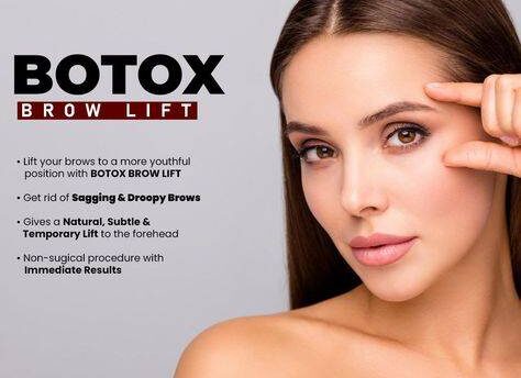 botox brow lift