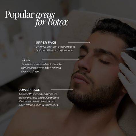 botox for men