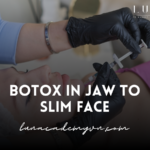 Botox in Jaw to Slim Face: Achieve a Refined Jawline