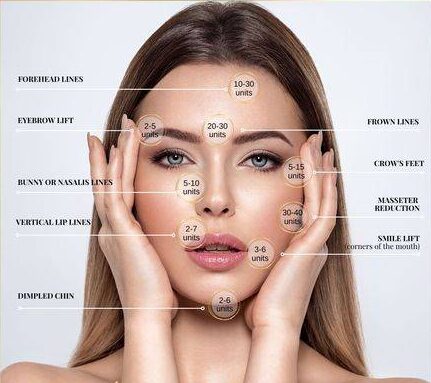 botox smile lines