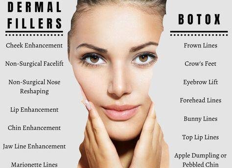 botox vs fillers 