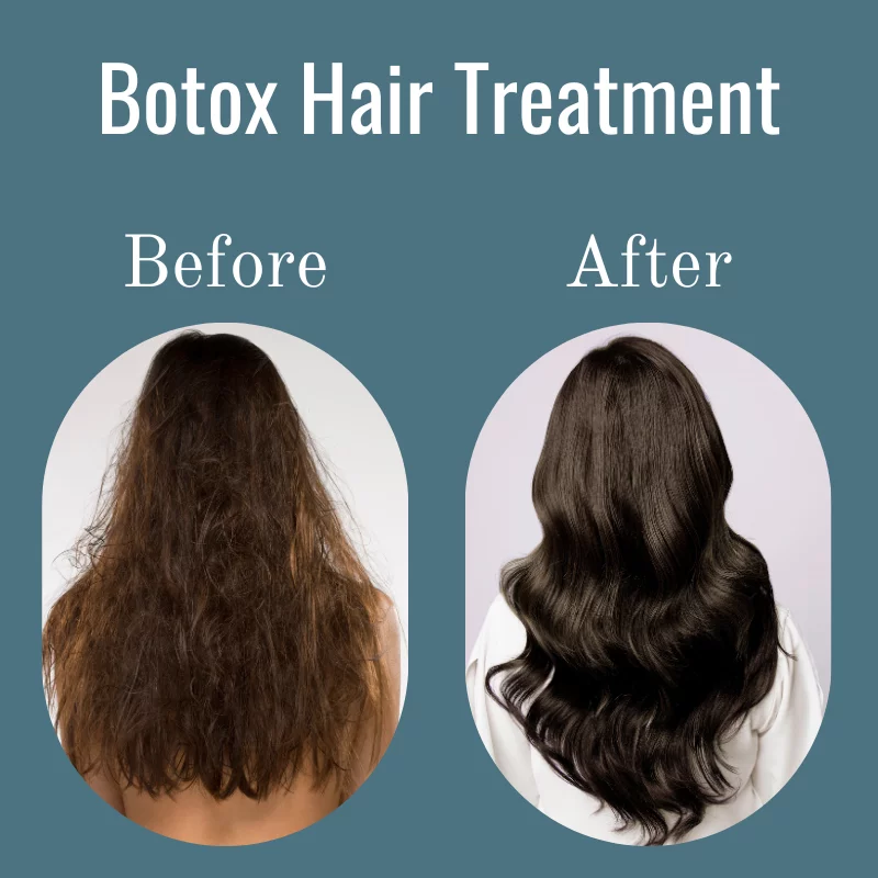 Common Disadvantages of Hair Botox Treatment