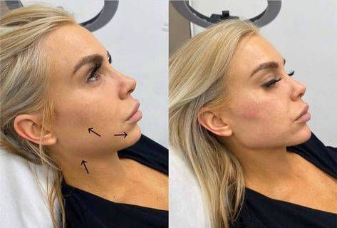 contouring facial