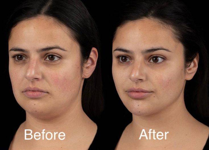 contouring facial