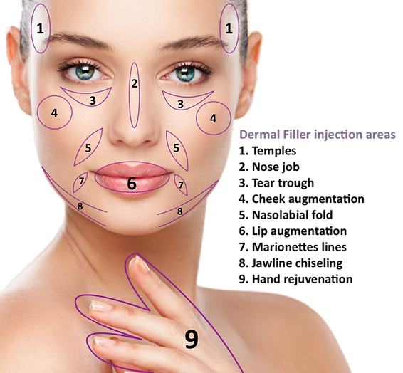 Dermal Fillers