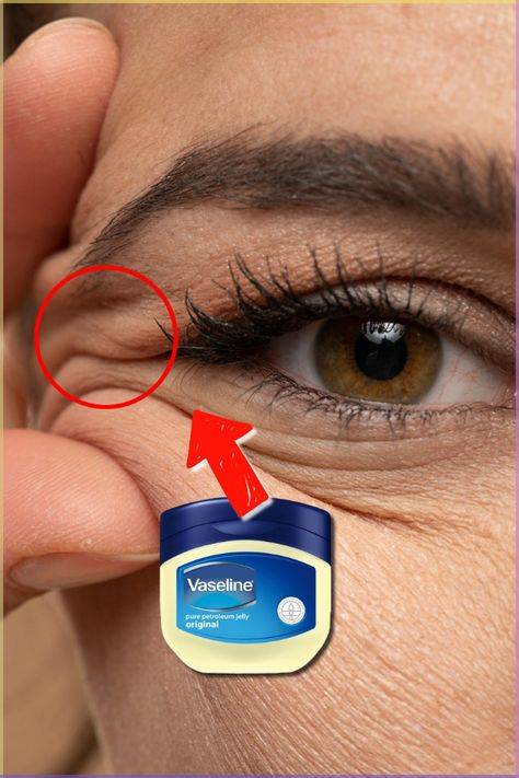 Does Vaseline help wrinkles