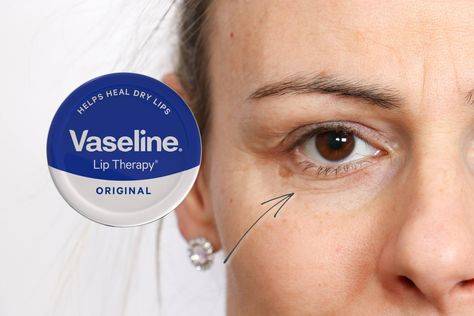 Does Vaseline help wrinkles