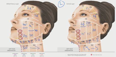 mesotherapy