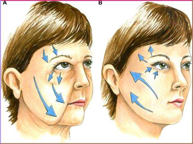 fat injections in face