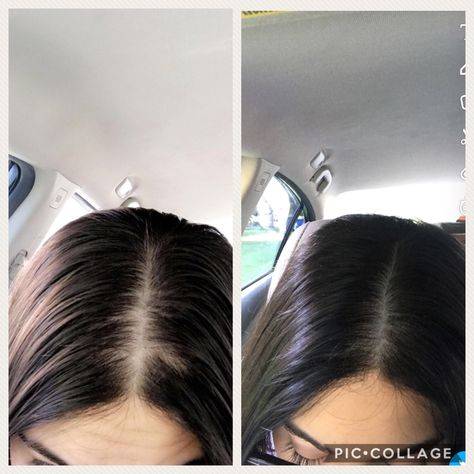 hair botox