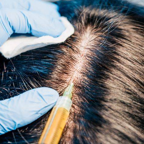 hair botox treatment disadvantage