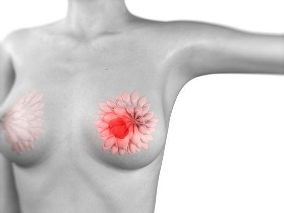 How Long Do Body Fillers Breast Last?