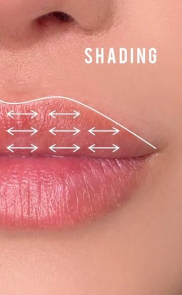 how long does hyaluronic acid lip filler last