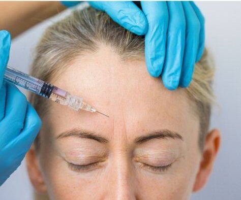 how long should botox last