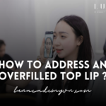 How to Address an Overfilled Top Lip ?