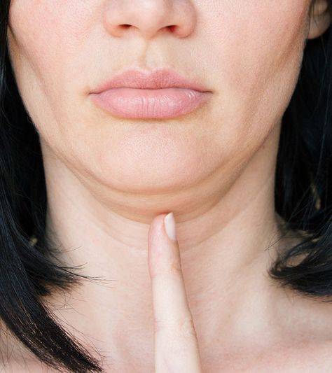 how to get rid of double chin