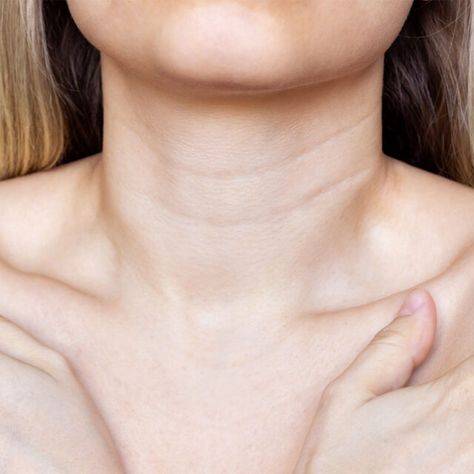 how to get rid of lines on neck