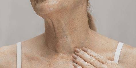 how to get rid of lines on neck