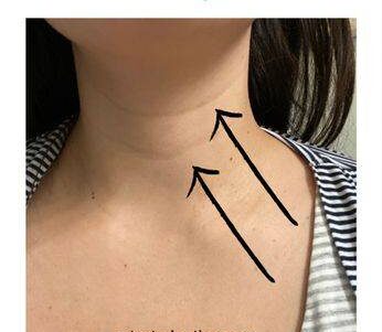 How to get rid of neck lines