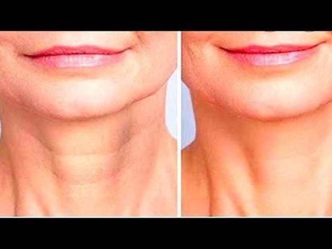 How to get rid of neck lines