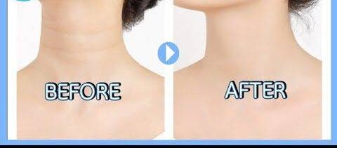 How to get rid of neck lines