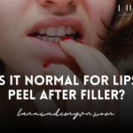 Is It Normal for Lips Peel After Filler?