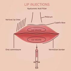 lip augmentation edinburgh